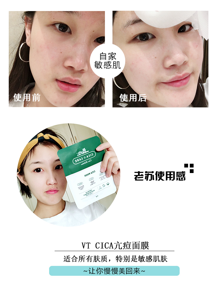 Vt hổ dán mặt nạ đậu hydrat đờm sạch lỗ chân lông nam và nữ sinh viên dán chăm sóc da sâu mặt nạ thạch