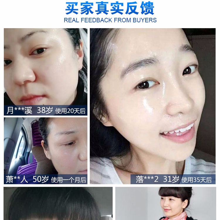 Đức axit hyaluronic gốc xác thực giữ ẩm ánh sáng nước kim mặt chất chất làm săn chắc axit uric giải pháp tinh chất klairs