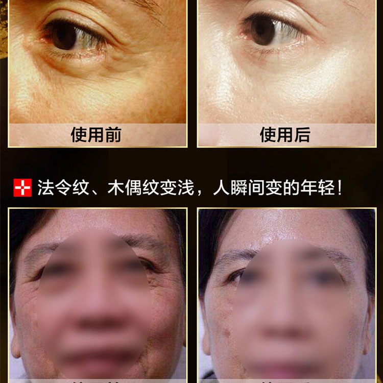 Liusheng peptide chống nhăn peptidase axit hyaluronic gốc xác thực giữ ẩm mặt chất làm săn chắc nâng mô hình serum c klairs