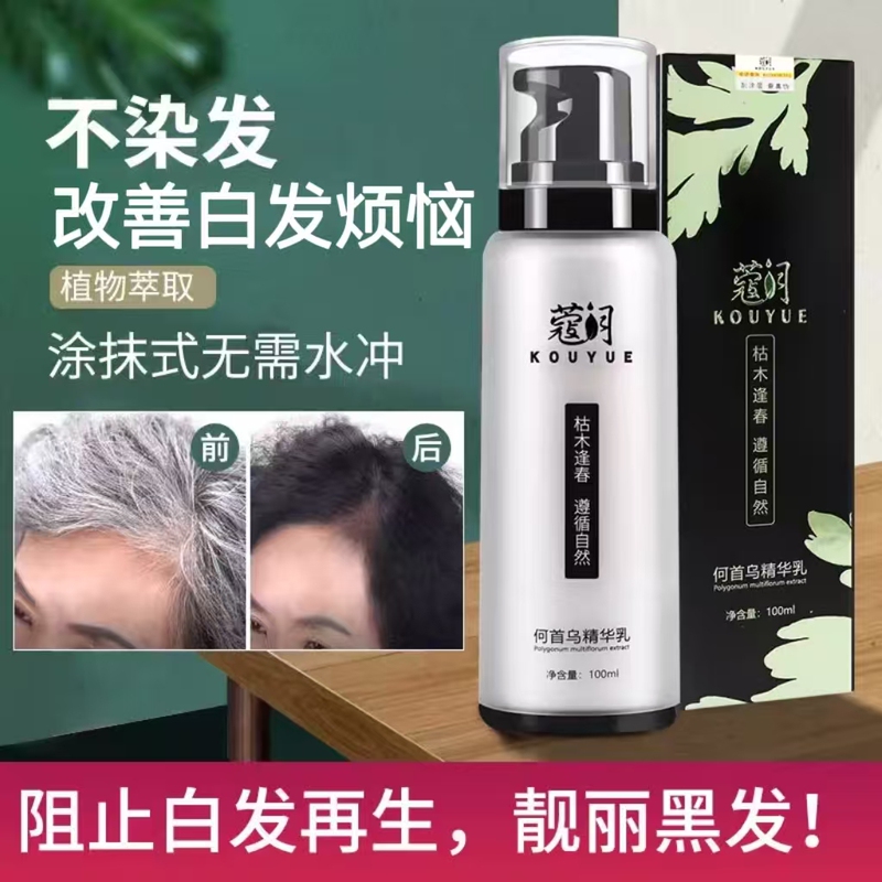 Kuoyue Polygonum Multiflorum Hair Nourishing Lotion, White Nourishing Nutrient Solution, No-Wash Essence for Lazy People, Nourishing and Moisturizing Hair Care, Anti-Allergic Kuoyue Polygonum Multiflorum Hair Nourishing Lotion, White Nourishing Nutrient Solution, No-Wash Essence for Lazy People, Nourishing and Moisturizing Hair Care, Anti-Allergic