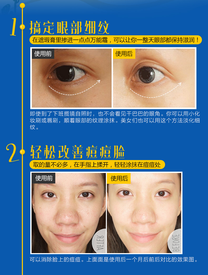 Mỹ nhập khẩu Yi Ji Mai Qi Ai Cập Magic kem dưỡng da Ai Cập kem ma thuật 118ml kem dưỡng ẩm - Kem dưỡng da vaseline dưỡng da