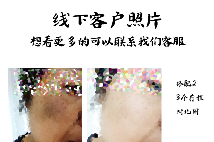 Mặt nạ tàn nhang nữ phai màu 37 bột làm trắng tinh khiết dược thảo Trung Quốc điều trị nho nho bảy đứa trẻ thẩm mỹ mặt nạ đất sét rep
