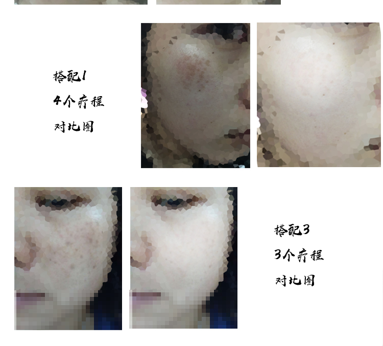 Mặt nạ tàn nhang nữ phai màu 37 bột làm trắng tinh khiết dược thảo Trung Quốc điều trị nho nho bảy đứa trẻ thẩm mỹ mặt nạ đất sét rep