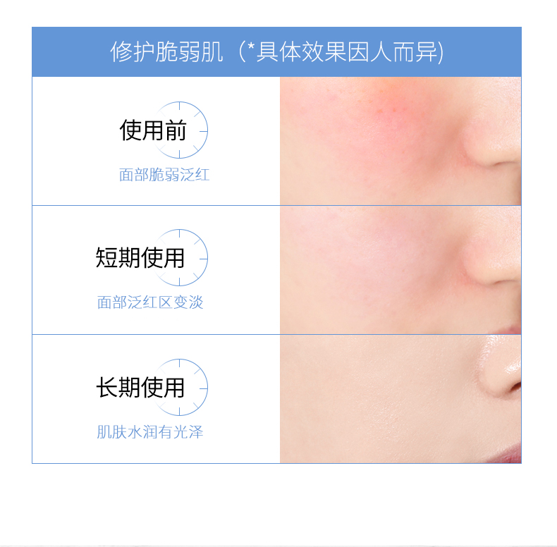 Đầu mùa hè bột đông khô oligopeptide chất lỏng pha loãng mụn trứng cá lỗ chân lông thu nhỏ lỗ chân lông trên khuôn mặt đàn ông đích thực serum 9wishes
