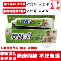 Buy 2 get 1 skin must be good baby skin baby Baowei skin cream anti-itching mosquitoes bite rash ringworm