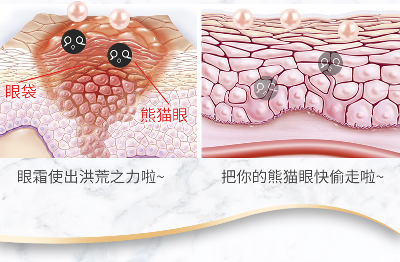 Tujia Sesame Bùn Làm Săn Chắc Kem Mắt để Desalination Tối Vòng Tròn Túi Mắt Dòng Fine Giữ Ẩm Nâng Eye Essence Chăm Sóc Mắt kem dưỡng vùng mắt