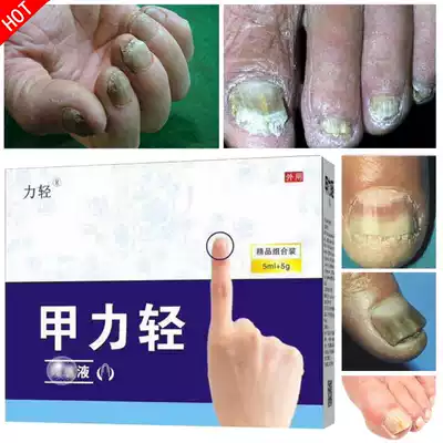 Go to the hands and feet, gray armor, become thick, white, powder, black, thickening, light armor, clear, hard and brittle.