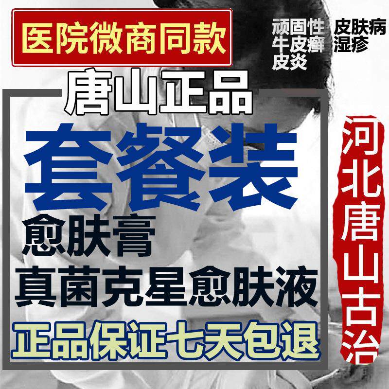 Buck's Fungus Buster Yufu Shuanghealing Cream Three Musketeers Tangshan Adults and Children Whole Body Universal Group