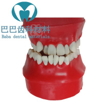 Dental model teeth model orthodontic practice wax embankment model orthodontic wax embankment tooth oral model