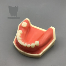 Dental oral mandibular half-mouth imitation bone loss planting practice model practice incision suture with magnet