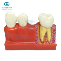 Dental Oral Teaching Model 4 times tooth decomposition model to show tooth morphology internal structure 