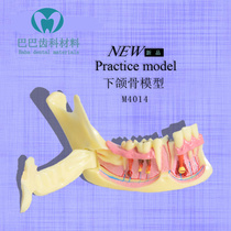Dental Jaw Bone Tissue Decomposition Model Half Side Can Open Root Caries Bad Tooth Decomposition Model 