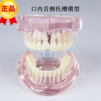 Dental Orthodontic model Intraoral lingual bracket model Invisible correction teaching model