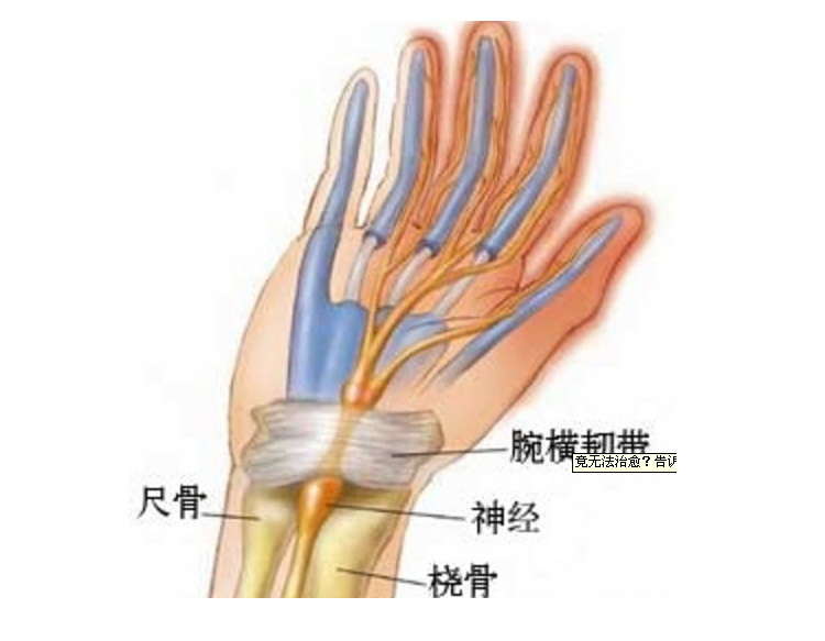 Coussin chauffant USB dessin animé - Ref 422182 Image 17