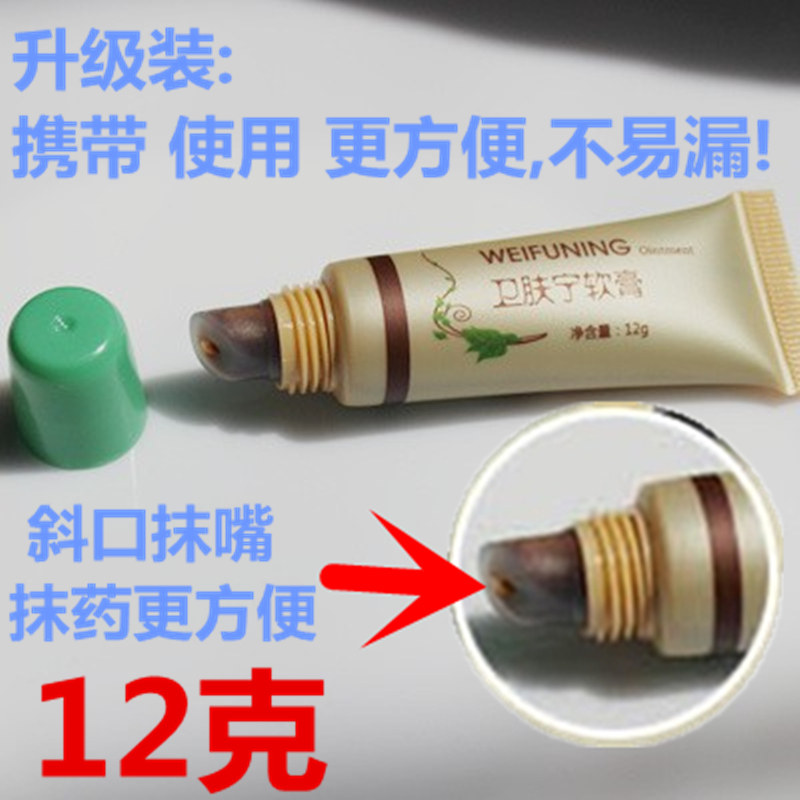 Scalm cream burn cream cream frozen sore bedsore and bedscar repair cream crack and crack crack hands and feet