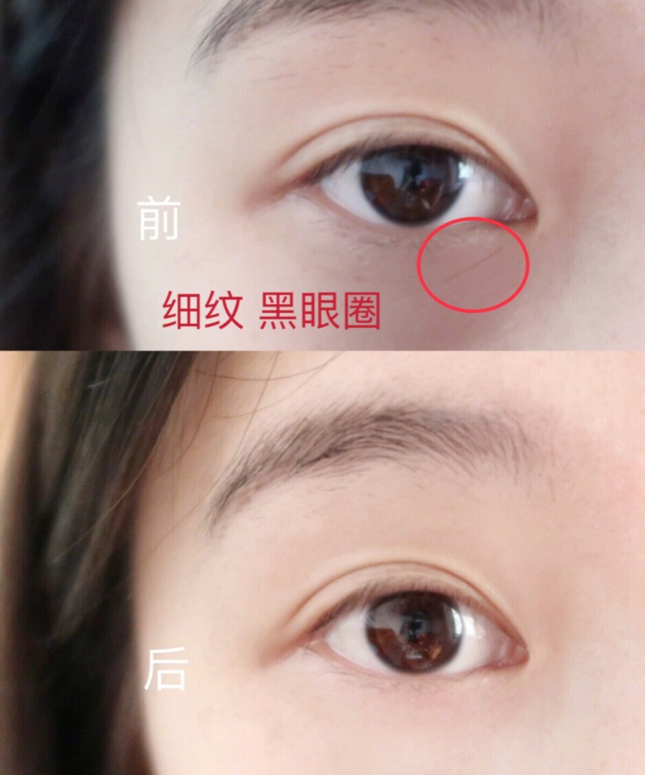 这款玻尿酸面膜补水真的这么神奇吗?15