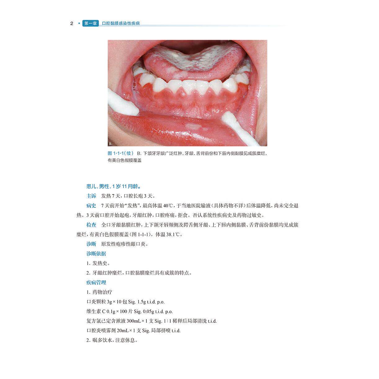 口腔黏膜病学》第3版，权威口腔医学教材详解-口腔科学-淘宝好物网