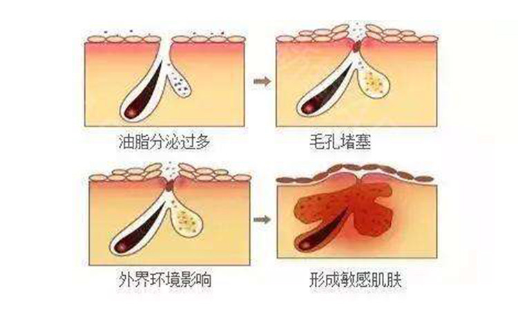 应对熬夜肌,三招轻松搞定 图5