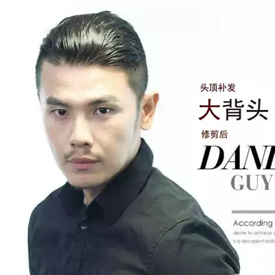 Invisible hairline woven hair Liuhai wig Male hair patch biological scalp forehead Mediterranean baldness custom T09