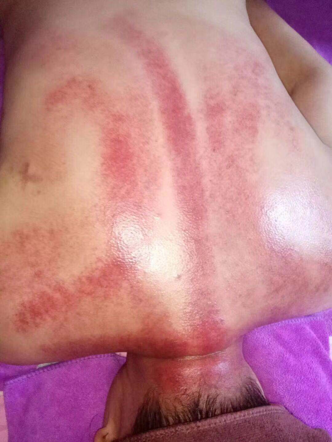 Thẩm mỹ viện da trường hợp 48 lần gừng phim sức khỏe cơ thể bộ hộp bảo trì buồng trứng tinh dầu thiết yếu - Tinh dầu điều trị tinh dầu mùi già