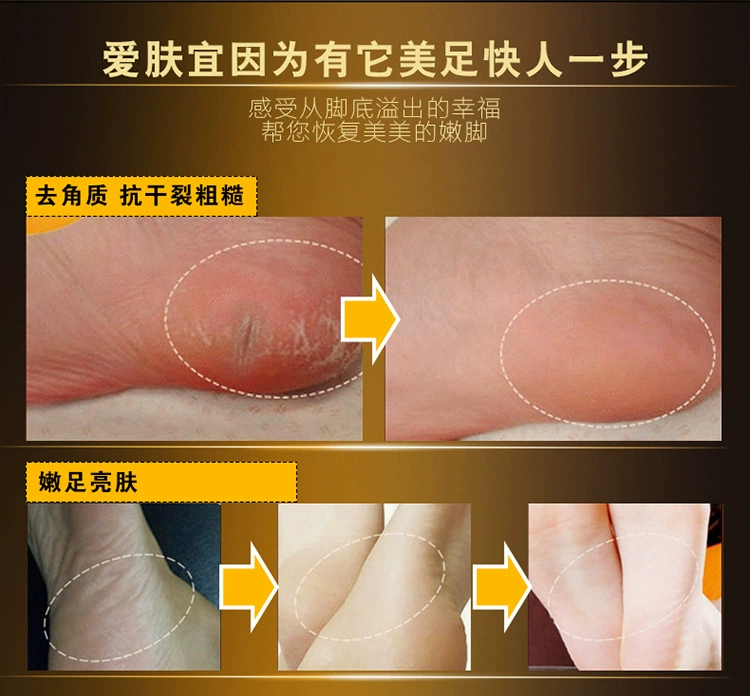 Kem dưỡng da tẩy tế bào chết cho da chân vàng 24K tẩy tế bào chết mềm mịn chân chống khô chân mặt nạ chân