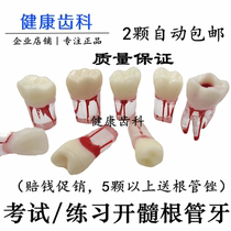 Resin Dentistry Students Practice Oral Skills Examination Resin Dental Dental Exam Dental teeth Tooth Grain Solid Tooth simulation Kaipoon