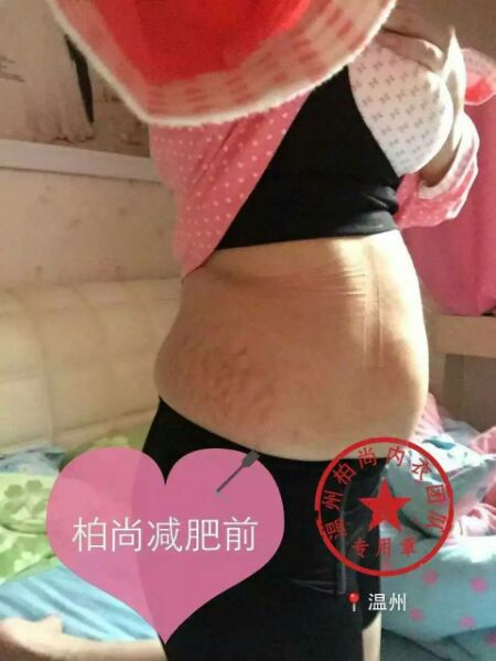 Body - Ref 648729 Image 14