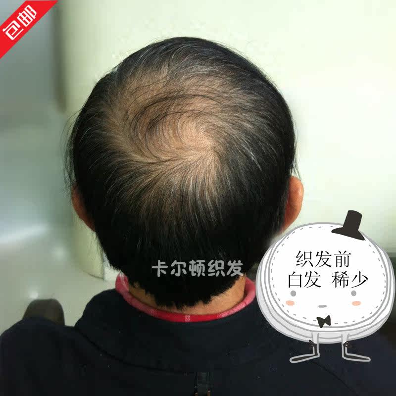 Extension mèches - Ref 224414 Image 9