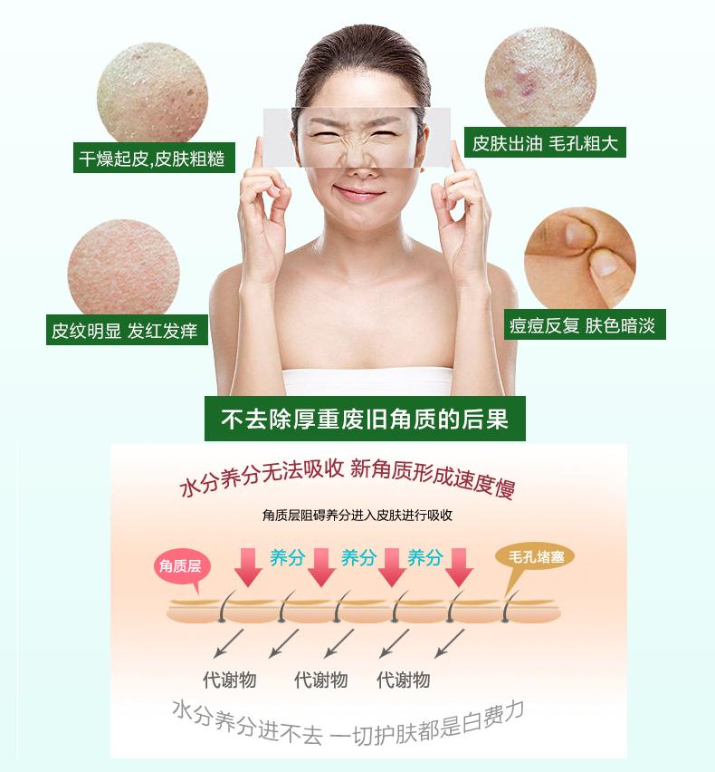 Tẩy tế bào chết trên mặt không gây dị ứng gel tẩy tế bào chết mặt nhẹ nhàng toàn thân tay và chân tẩy tế bào chết cho da hỗn hợp