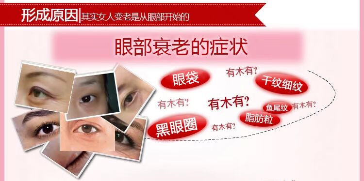 Nước Watson vẫn là đích thực, kem làm dịu mắt, tinh chất chăm sóc mắt, quầng thâm, túi mắt, nếp nhăn kem bôi mắt