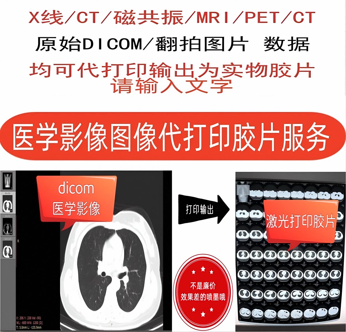 医学影像CT/MRI磁共振/DR X光线原始DICOM/DCM数据图片打印胶片:你的健康报告新方式!🏥🔍-快显胶片-淘宝好物网