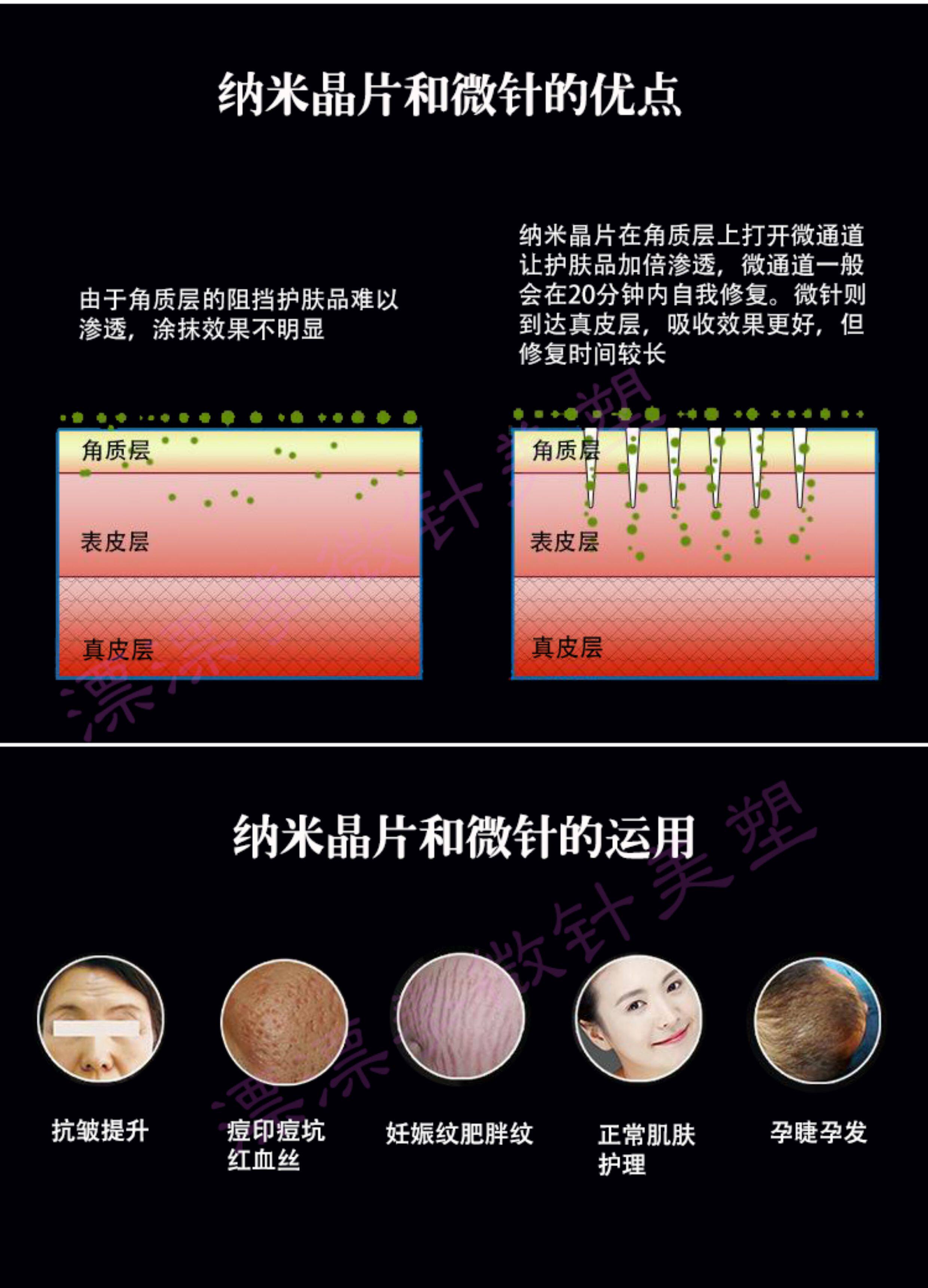 Импорт и экспорт документов dr.pen n2卡口充电电动微针仪微晶笔纳米晶片微针促渗透仪