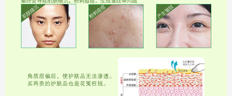 Chính hãng Melanie aloe tẩy tế bào chết mặt tẩy tế bào chết mụn đầu đen dưỡng ẩm sâu gel làm sạch nam giới và phụ nữ chà tẩy tế bào chết innisfree