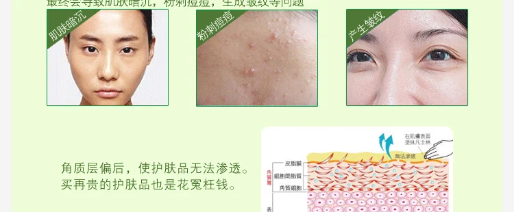 Chính hãng Melanie aloe tẩy tế bào chết mặt tẩy tế bào chết mụn đầu đen dưỡng ẩm sâu gel làm sạch nam giới và phụ nữ chà