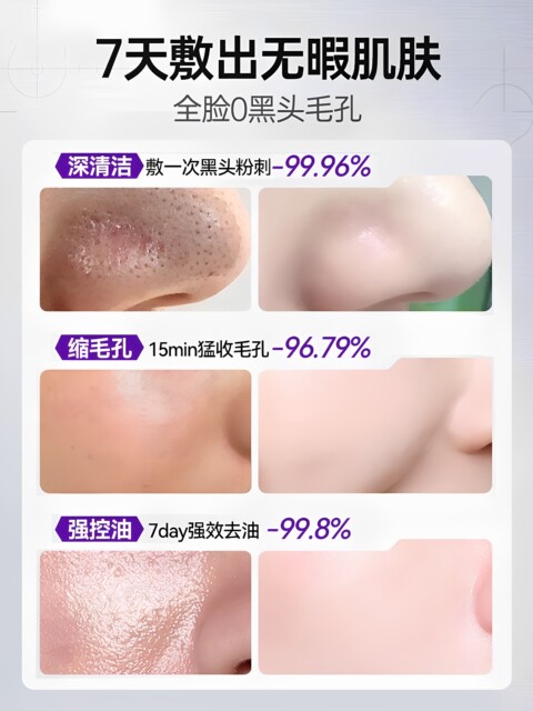 Perilla cleansing mud mask ຮູຂຸມຂົນນ້ອຍລົງ, ລົບຫົວດໍາແລະສິວ, azelaic acid cleansing deep cleansing facial mask for oily skin