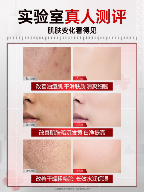 ພິເສດສຳລັບທ່ານຊາຍຄວບຄຸມຄວາມມັນ, ຄວາມຊຸ່ມຊື້ນ, ແລະຄວາມຊຸ່ມຊື້ນຂອງໃບໜ້າ, ກຳຈັດຄວາມໝອງຄ້ຳ, ຮູຂຸມຂົນນ້ອຍລົງ, ແລະ ຮອຍສິວຈາງລົງ, ຜະລິດຕະພັນຂອງແທ້ຈິງ