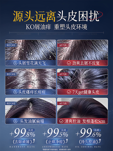 ແຊມພູ Selenium disulfide, ຕ້ານ dandruff, ຕ້ານອາການຄັນ, ຄວບຄຸມຄວາມມັນ, ແຊມພູຮາກຜົມ fluffy, ຜູ້ຊາຍແລະແມ່ຍິງຢ່າງເປັນທາງການຍີ່ຫໍ້ສິນຄ້າຂອງແທ້