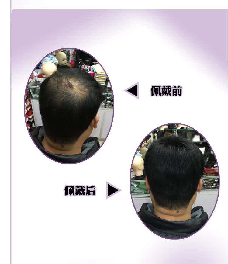 Extension cheveux - Ref 218580 Image 18