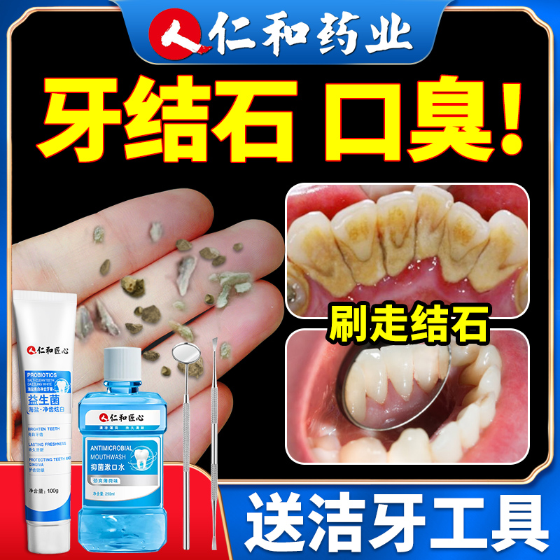 Renhe Pharmaceutical Toothpaste Whitening, Halitosis, Dental Stones, Dental Stones, Dental Stal Dissolution, Special for Men and Girls