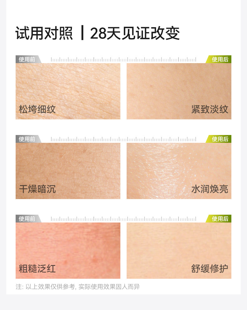 十月结晶旗舰店产后橄榄精华妊娠油备孕护理精油抚纹淡化肥胖纹 — 10