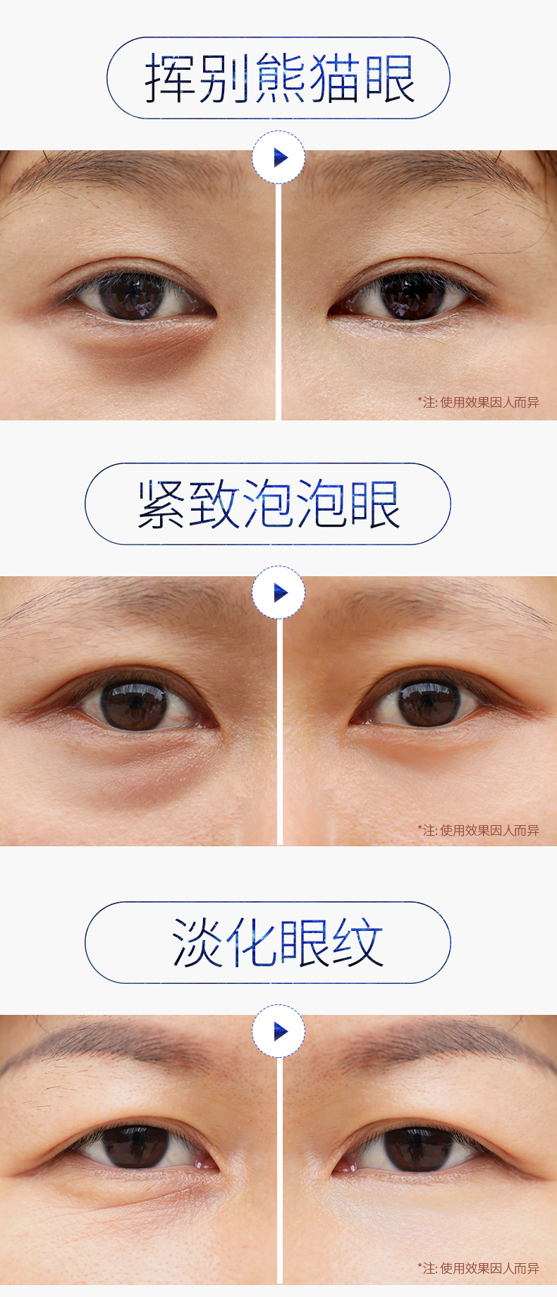 马应龙旗下 瞳话 眼膜贴 60片 抗皱淡化黑眼圈 图6
