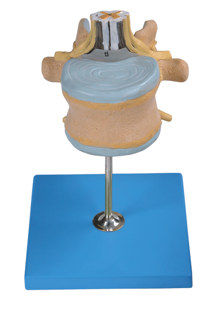腰椎附脊髓与马尾神经放大模型GD/A18107