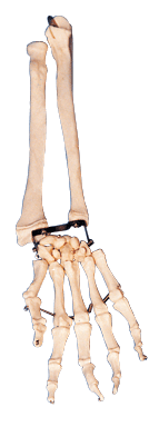 手掌骨带尺骨和桡骨模型/解剖模型A11125