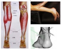 (Réadaptation haotienne) Rupture du tendon dAchille blessures aux ligaments du pied et de la cheville conseils professionnels sur la rééducation des blessures à larticulation du genou