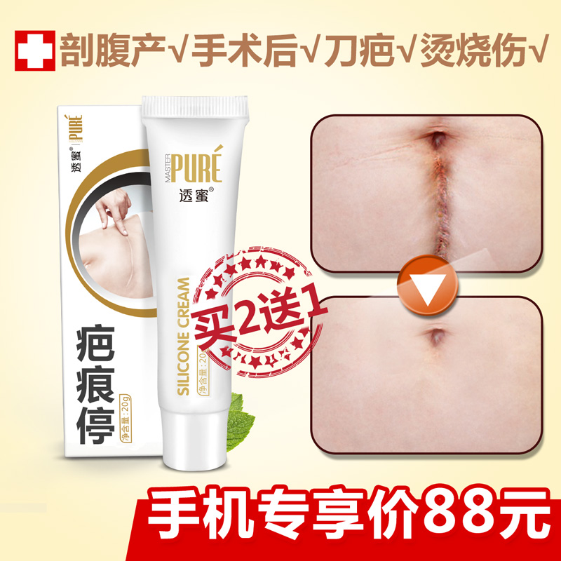 【买2送1】疤痕灵凹凸疤剖腹产手术疤痕修复淡疤膏烫烧伤疤疙瘩