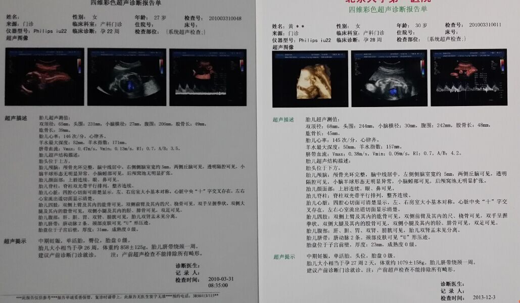 Porcelain White Inkjet Laser Dual-use Medical color laser printing negatives A4 double-sided printed color ultra-PET sheet