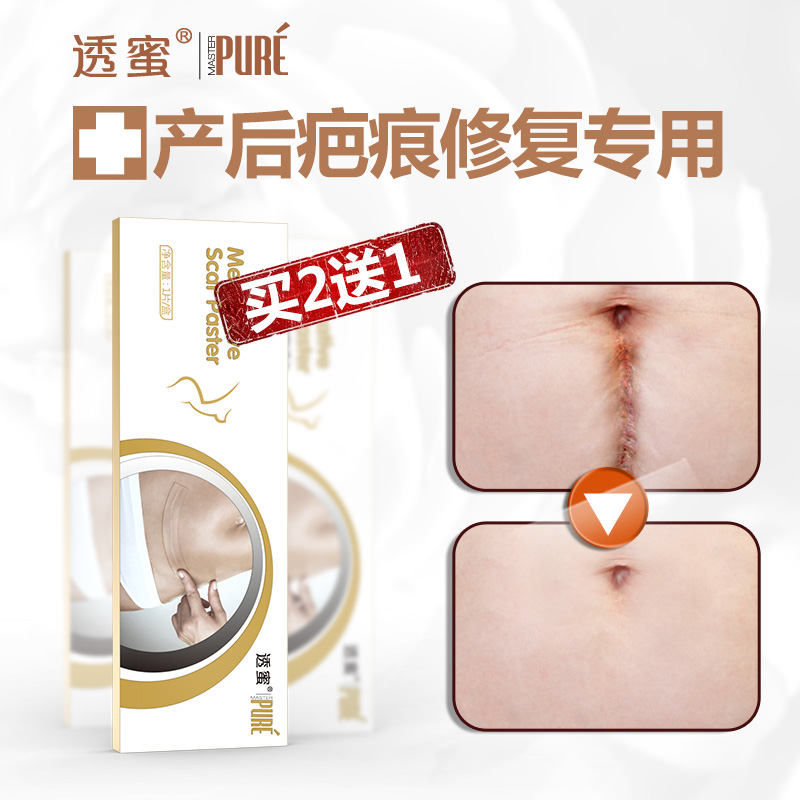 疤痕贴  产后增生修复胶带 免缝疤痕修复贴 剖腹产刀疤手术疤