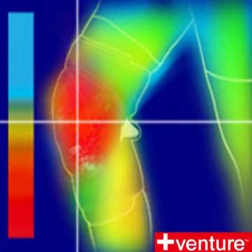 【美国+venture】低电压热敷护膝(KB-1280)台湾官网直邮进口