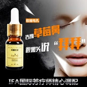 享 Hợp chất làm sạch sâu tinh dầu 10ML đến mụn đầu đen thu nhỏ lỗ chân lông Công thức chuyên nghiệp Aromatherapist