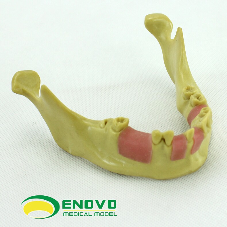 ENOVO齿科种植实训模型 口腔种植教学实验器材